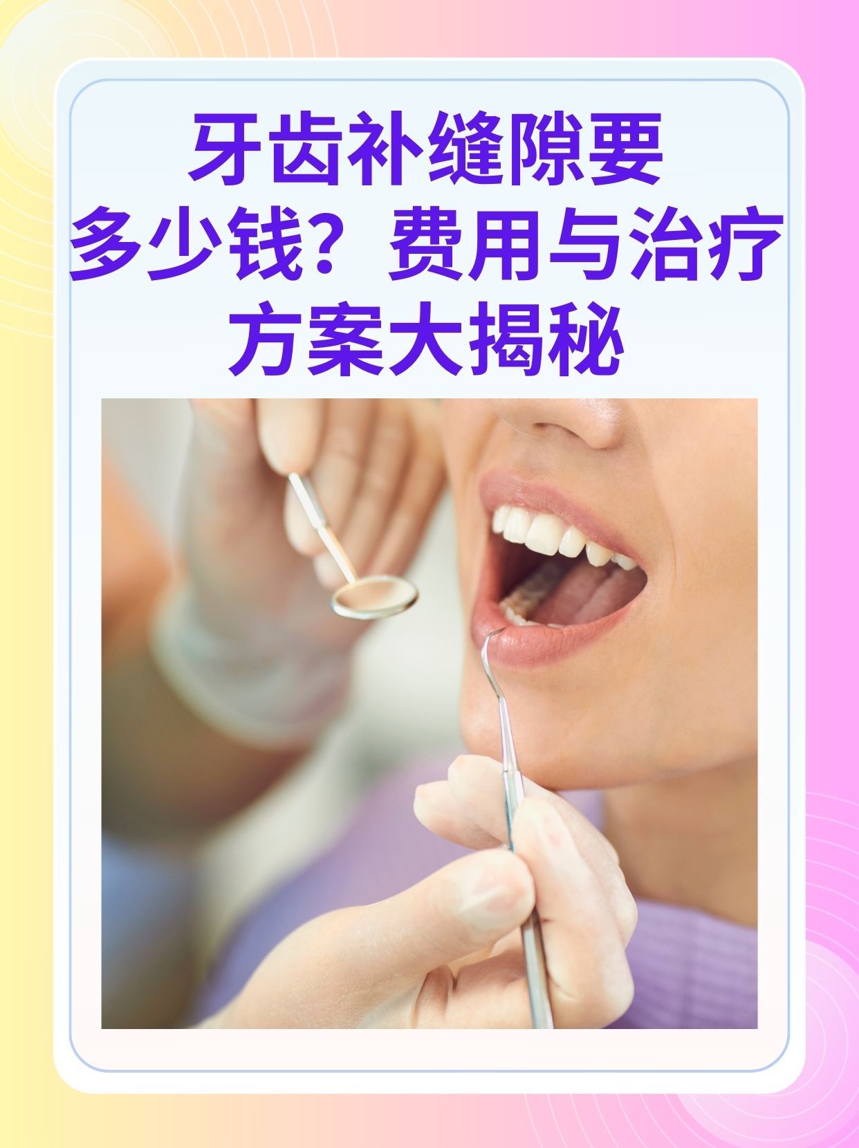 来宾补牙医保可以报销吗(补牙医保可以报销吗 哪些可以报销呢)